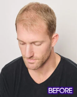 Dignified | Average/Large Men's Lace Front & Monofilament Top Synthetic Wig By HIM -Best Wig Outlet Store HIM64014AL Dignified Model2 Before